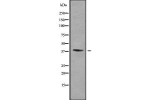 Western blot analysis of WNT16 using Jurkat whole cell lysates (WNT16 抗体  (C-Term))