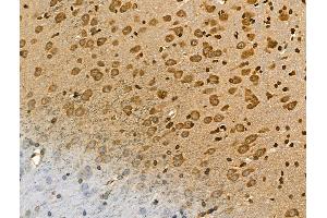 ABIN7094432 and ABIN7098480 at 1/100 staining Rat brain tissue by IHC-P.
