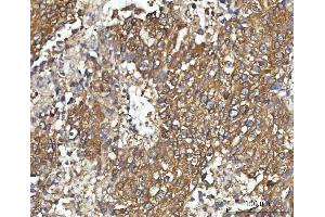 IHC analysis of CBR1 using anti-CBR1 antibody (ABIN7600015). (CBR1 抗体  (AA 14-262))