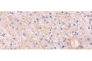 Immunohistochemistry of paraffin-embedded Human tonsil tissue using KANSL1L Polyclonal Antibody at dilution of 1:40(x200) (KANSL1L 抗体)