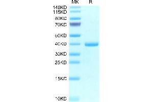 Epiregulin Protein (EREG) (AA 63-108) (Fc Tag)