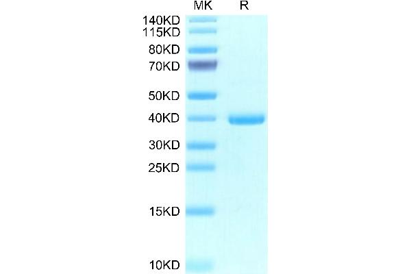 Epiregulin Protein (EREG) (AA 63-108) (Fc Tag)