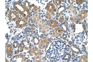 DCXR antibody was used for immunohistochemistry at a concentration of 4-8 ug/ml to stain Epithelial cells of renal tubule (arrows) in Human Kidney. (DCXR 抗体  (Middle Region))