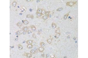 Immunohistochemistry of paraffin-embedded Rat brain using CHMP1B Polyclonal Antibody at dilution of 1:100 (40x lens). (CHMP1B 抗体)