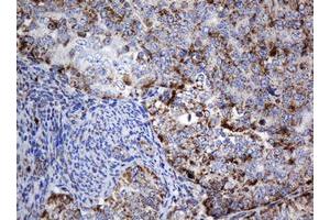 Image no. 1 for anti-NADH Dehydrogenase (Ubiquinone) 1 beta Subcomplex, 10, 22kDa (NDUFB10) antibody (ABIN1499672) (NDUFB10 抗体)