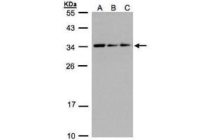 WB Image Sample(30 ug whole cell lysate) A:293T B:A431, C:H1299 12% SDS PAGE antibody diluted at 1:1000 (SARNP 抗体)