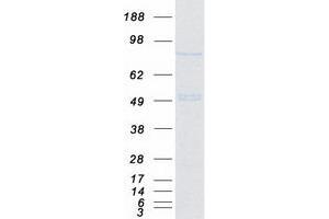 Validation with Western Blot (MTA1 Protein (Myc-DYKDDDDK Tag))