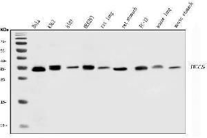 Western blot analysis of HCCS using anti-HCCS antibody (ABIN7602424).