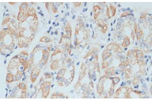 Immunohistochemistry of paraffin-embedded Human stomach using ADAM9 Polyclonal Antibody at dilution of 1:100 (40x lens).