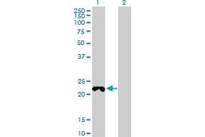 Western Blot analysis of COX4NB expression in transfected 293T cell line by COX4NB MaxPab polyclonal antibody. (COX4NB 抗体  (AA 1-210))