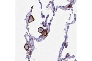 Immunohistochemical staining (Formalin-fixed paraffin-embedded sections) of human lung with SPN polyclonal antibody  shows strong membranous positivity in a subset of macrophages and pneumocytes. (CD43 抗体  (AA 315-394))