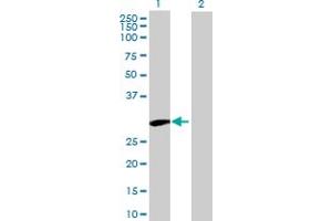 Western Blot analysis of UBTD1 expression in transfected 293T cell line by UBTD1 MaxPab polyclonal antibody. (UBTD1 抗体  (AA 1-227))