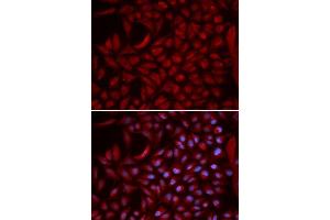Immunofluorescence analysis of U2OS cells using CUL5 antibody. (Cullin 5 抗体  (AA 1-300))