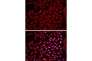 Immunofluorescence analysis of U2OS cells using CUL5 antibody. (Cullin 5 抗体  (AA 1-300))