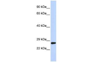 WB Suggested Anti-SETD4 Antibody Titration:  0. (SETD4 抗体  (C-Term))