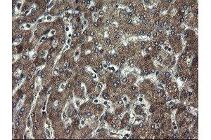 Immunohistochemical staining of paraffin-embedded Human liver tissue using anti-DOK7 mouse monoclonal antibody. (DOK7 抗体)