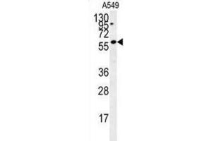Western Blotting (WB) image for anti-PARP1 Binding Protein (PARPBP) antibody (ABIN2995516) (PARPBP 抗体)