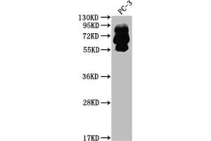 Western Blot Positive WB detected in: PC-3 whole cell lysate All lanes: PCSK9 antibody at 1:2000 Secondary Goat polyclonal to rabbit IgG at 1/50000 dilution Predicted band size: 75, 21 kDa Observed band size: 60, 75 kDa (Recombinant PCSK9 抗体)