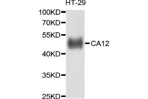 Western blot analysis of extracts of HT-29 cells, using CA12 antibody (ABIN5997338) at 1/1000 dilution. (CA12 抗体)
