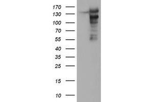 Western Blotting (WB) image for anti-ATP/GTP Binding Protein 1 (AGTPBP1) (AA 368-753) antibody (ABIN1491460) (AGTPBP1 抗体  (AA 368-753))
