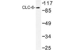 Image no. 1 for anti-Chloride Channel, Voltage-Sensitive 6 (CLCN6) antibody (ABIN317827) (CLCN6 抗体)