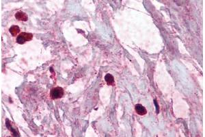 Human Breast, Mast Cells (formalin-fixed, paraffin-embedded) stained with TPSAB1 antibody ABIN337075 at 2. (TPSAB1 抗体)