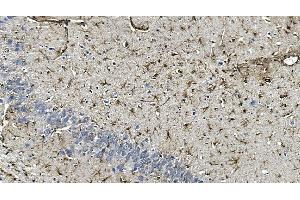 IHC analysis of GFAP using anti-GFAP antibody (ABIN7602675). (GFAP 抗体  (AA 93-432))