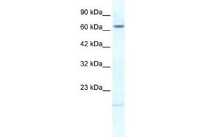 Western Blotting (WB) image for anti-Potassium Voltage-Gated Channel, Subfamily H (Eag-Related), Member 6 (KCNH6) (N-Term) antibody (ABIN2776259)
