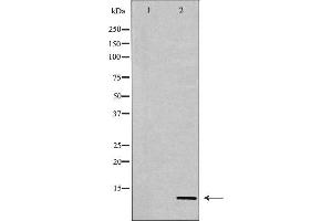 Western blot analysis of Hela whole cell lysates, using Histone H4K20me3 Antibody. (Histone H4 抗体  (3meLys20))
