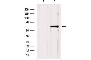 Western blot analysis of extracts from Hela, using CBS Antibody. (CBS 抗体  (Internal Region))
