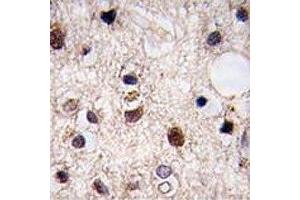 IHC analysis of FFPE human brain tissue stained with JMJD3 (Kdm6b 抗体  (AA 1-30))
