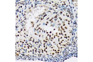 Immunohistochemistry of paraffin-embedded rat ovary using SF3B1 Rabbit mAb (ABIN7270542) at dilution of 1:100 (40x lens). (SF3B1 抗体)
