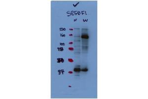 WB Suggested Antibody Titration:  1:1,000   Positive Control:  HepG2 (SREBF1 抗体  (N-Term))