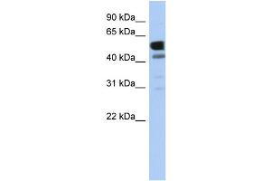 WB Suggested Anti-LDHD Antibody Titration: 0. (LDHD 抗体  (Middle Region))