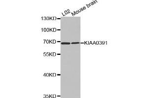 Western Blotting (WB) image for anti-KIAA0391 (KIAA0391) antibody (ABIN1875480) (KIAA0391 抗体)