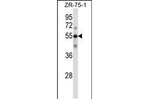 Western blot analysis in ZR-75-1 cell line lysates (35ug/lane). (C9 抗体  (AA 191-220))