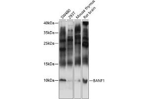 Western blot analysis of extracts of various cell lines, using B antibody (ABIN7265827) at 1:3000 dilution. (BANF1 抗体  (AA 1-89))