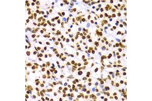 Immunohistochemistry (IHC) image for anti-Histone 3 (H3) (H3K9me2) antibody (ABIN3023260)