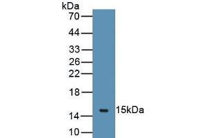 Detection of Recombinant CHRM3, Human using Polyclonal Antibody to Cholinergic Receptor, Muscarinic 3 (CHRM3) (CHRM3 抗体  (AA 1-104))