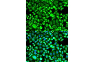 Immunofluorescence analysis of A549 cells using PSMB8 antibody. (PSMB8 抗体  (AA 163-272))
