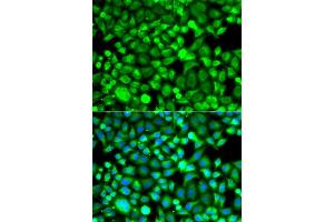 Immunofluorescence (IF) image for anti-Proteasome (Prosome, Macropain) Subunit, beta Type, 8 (Large Multifunctional Peptidase 7) (PSMB8) (AA 163-272) antibody (ABIN6146321)