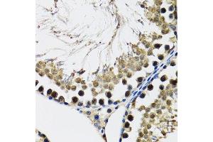 Immunohistochemistry (Paraffin-embedded Sections) (IHC (p)) image for anti-DEAD (Asp-Glu-Ala-Asp) Box Polypeptide 41 (DDX41) (AA 1-300) antibody (ABIN6139498)