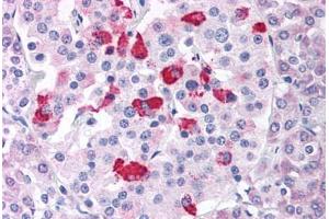 Pancreas (BACE1 抗体  (Internal Region))