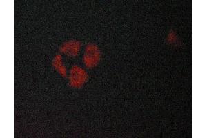 ABIN6269097 staining Hela cells by ICC/IF. (KRT8 抗体  (C-Term))