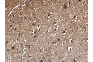 IHC-P Image DCK antibody detects DCK protein at nucleus on mouse hind brain by immunohistochemical analysis. (DCK 抗体)