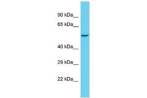 Host: Rabbit Target Name: SAMD1 Sample Type: NCI-H226 Whole Cell lysates Antibody Dilution: 1.