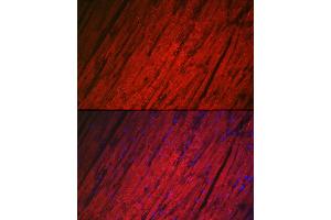 Immunofluorescence analysis of rat heart using HSPB8/HSP22 Rabbit pAb (ABIN3016166, ABIN3016167, ABIN3016168 and ABIN6219596) at dilution of 1:100 (40x lens). (HSPB8 抗体  (AA 1-196))
