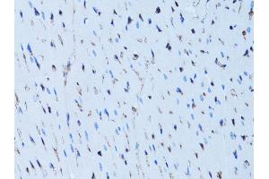 Immunohistochemistry of paraffin-embedded rat heart using FABP4 antibody (ABIN5970061) at dilution of 1/100 (40x lens).
