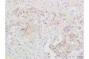 Immunohistochemistry (Paraffin-embedded Sections) (IHC (p)) image for anti-TNF Receptor-Associated Factor 3 (TRAF3) (AA 101-200) antibody (ABIN738921)