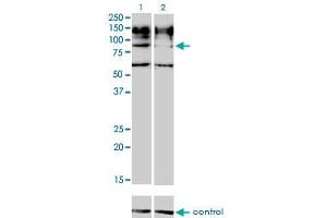 Western blot analysis of IL31RA over-expressed 293 cell line, cotransfected with IL31RA Validated Chimera RNAi (Lane 2) or non-transfected control (Lane 1).